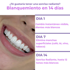 Tiras Blanqueadoras Moradas LUME