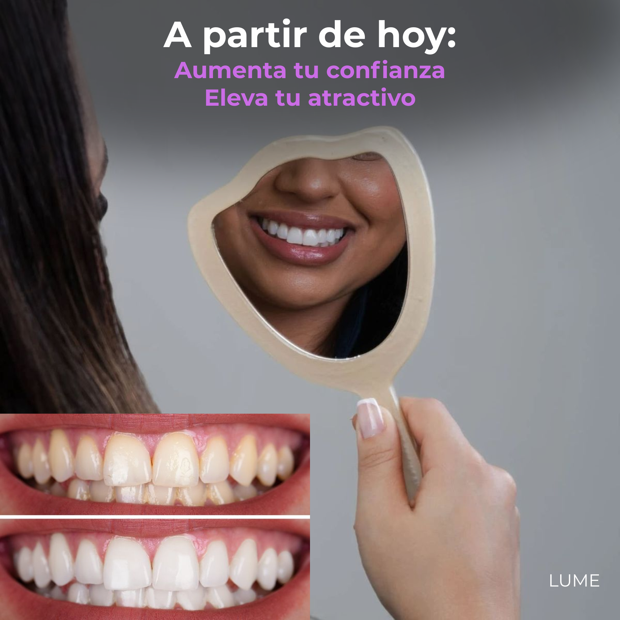 Tiras Blanqueadoras Moradas LUME